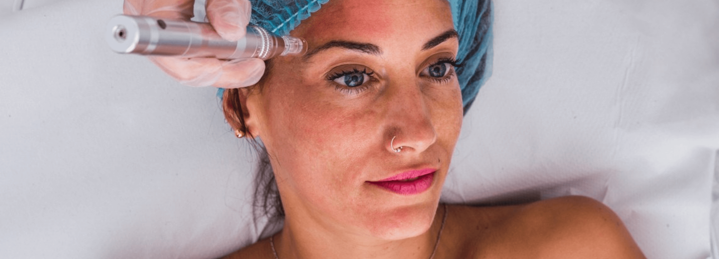 Transform Your Skin: Microneedling Results Explained – microneedling pen treatment on woman’s face to improve texture and fine lines