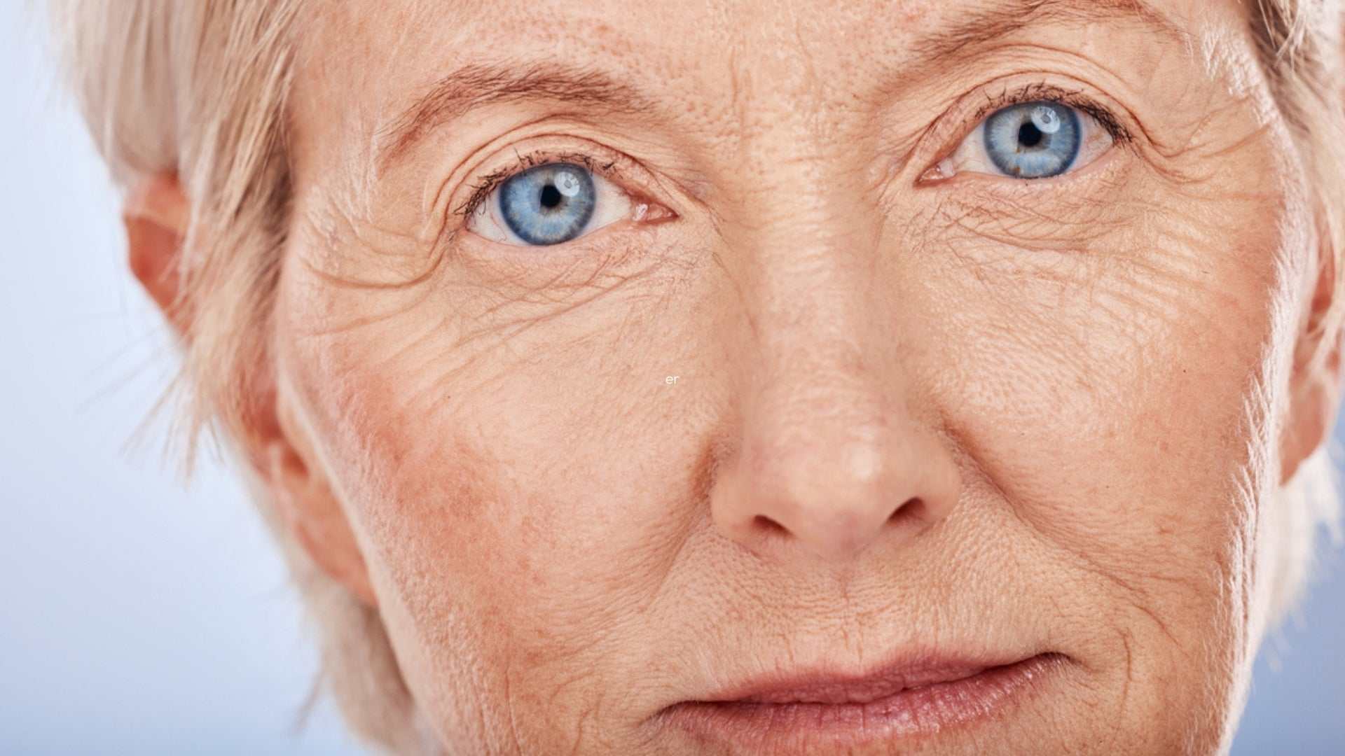 Close-up of an older woman’s face showing wrinkles and fine lines illustrating the aging process and its effects on skin elasticity and texture.