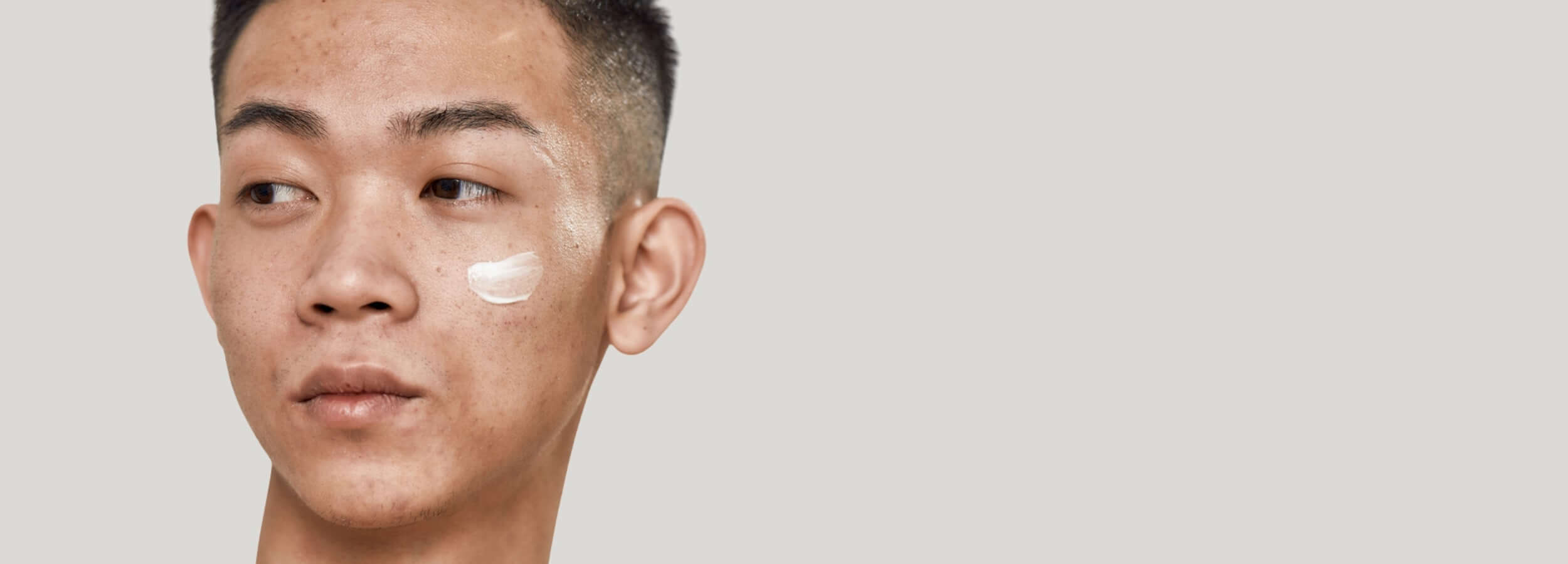 Alt Tag: Understanding Hyperpigmentation Laser Treatment Options - man with facial dark spots applying skincare cream for hyperpigmentation removal