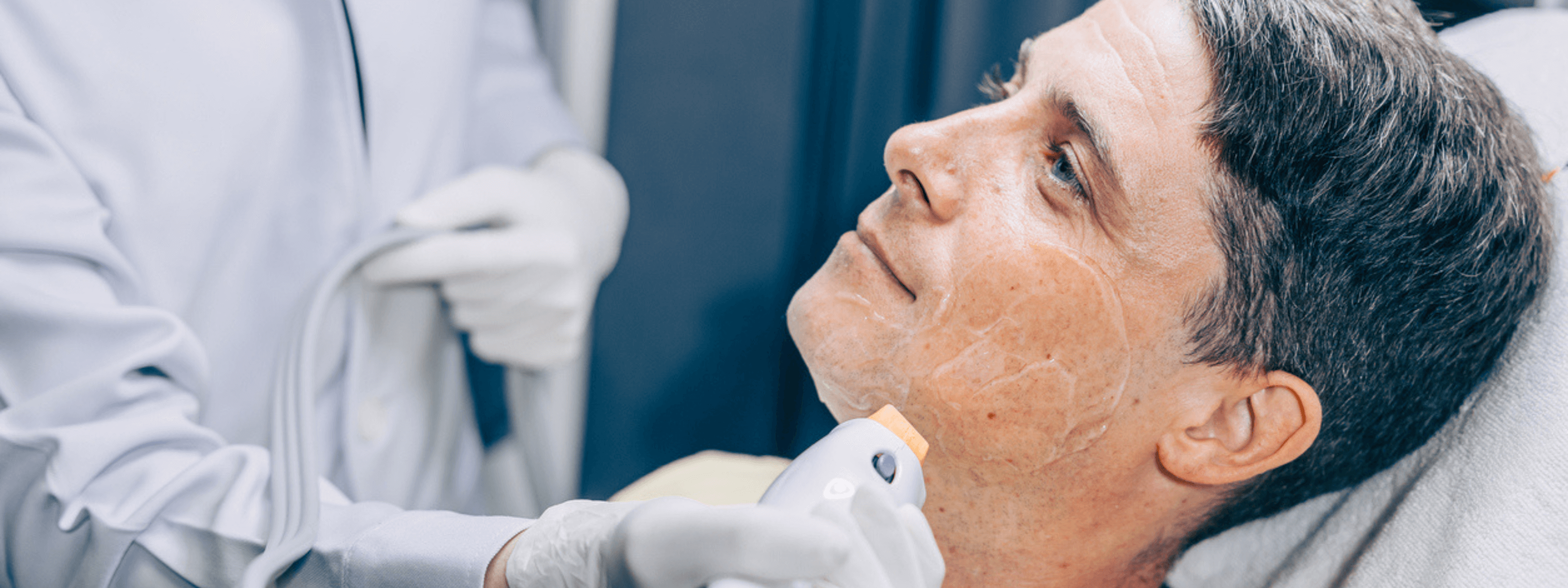 Is Pico Laser Worth The Investment - dermatologist performing pico laser skin rejuvenation treatment on patient's face