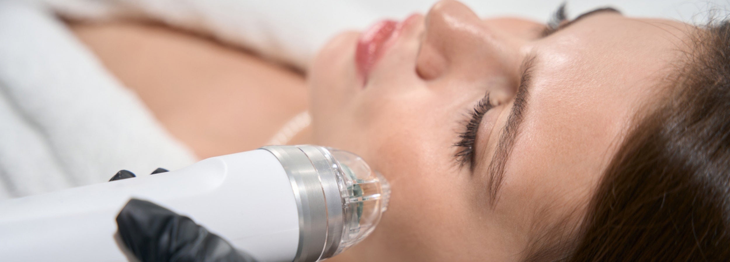 woman receiving microneedling serum treatment