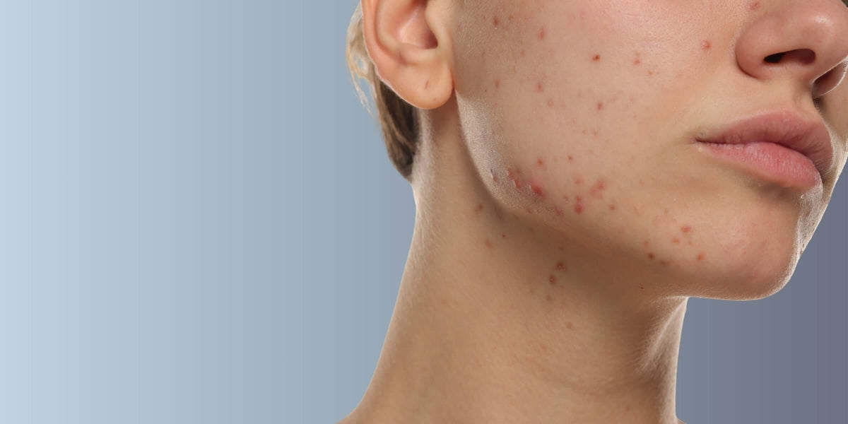 Patient Favourites – In-Clinic Treatments