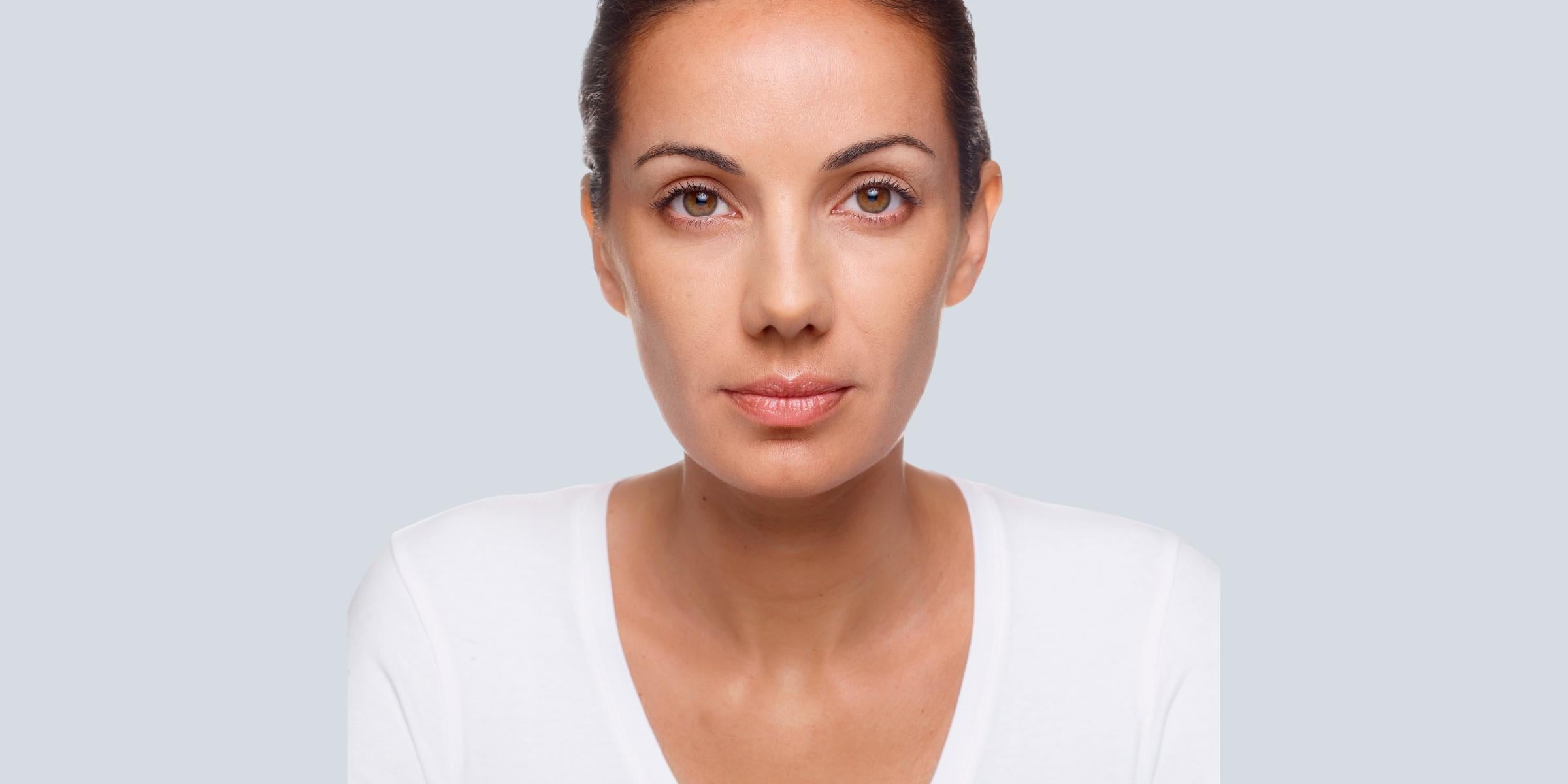 Botox_After_Image