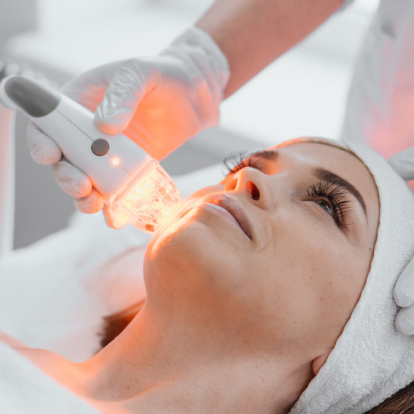 Woman receiving a facial treatment. Three-session Cynosure Ultra laser resurfacing program for face and neck rejuvenation with LED therapy - comprehensive dual-zone transformation at Merrion Medical Aesthetics Oakville