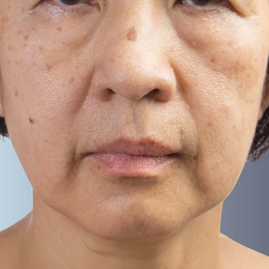 Sagging Skin 1080 x 1080 .jpg