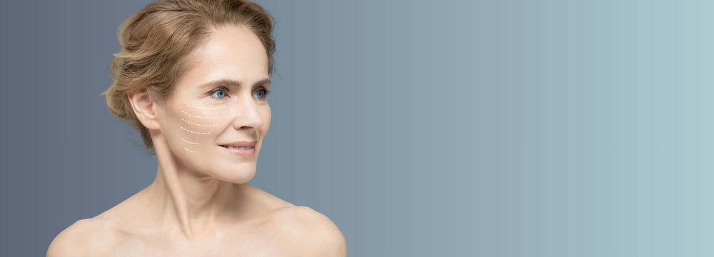 Best facial treatment for aging skin, mature woman with facelift contour lines on face, skincare rejuvenation concept