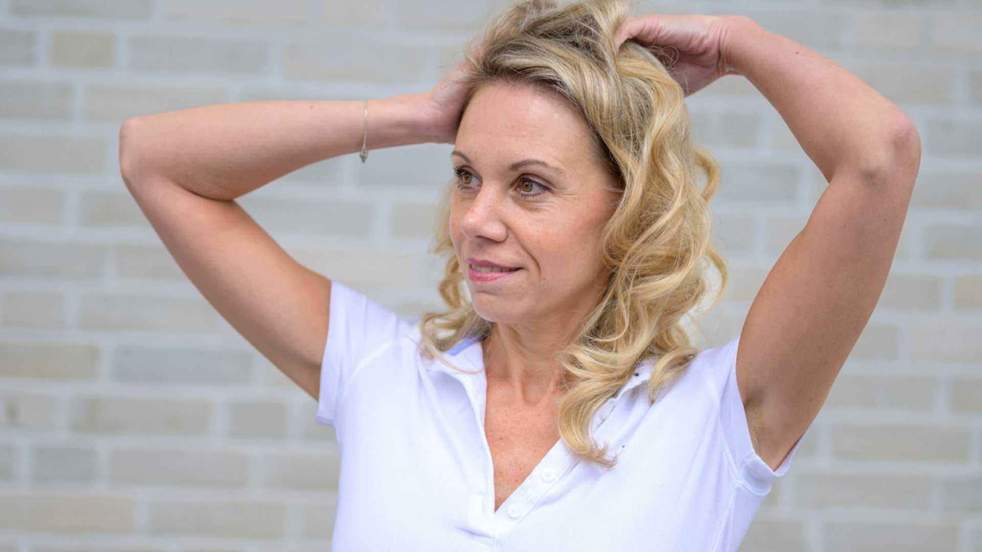 Exploring Botox Treatments in Burlington, Ontario – woman with smooth, refreshed skin adjusting hair, natural results, minimal downtime