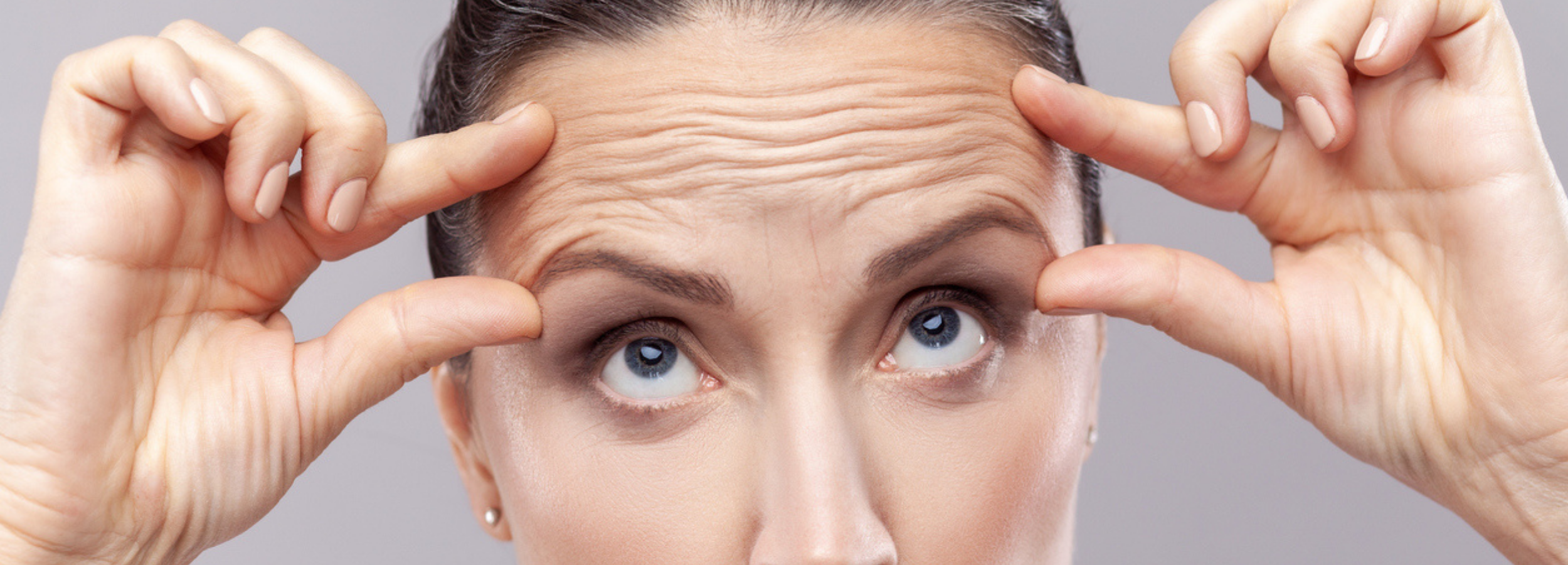 Woman scrunches forehead to show fine lines and wrinkles that Botox to forehead can remove