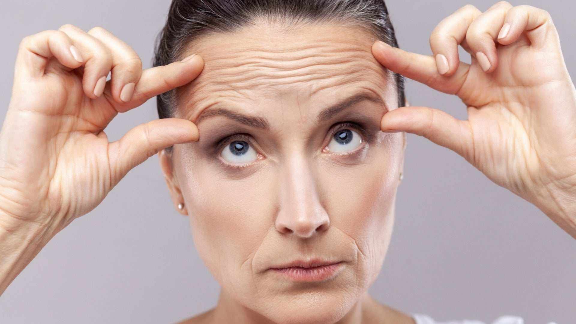 Woman stretching forehead skin showing forehead wrinkles and lines before botox treatment