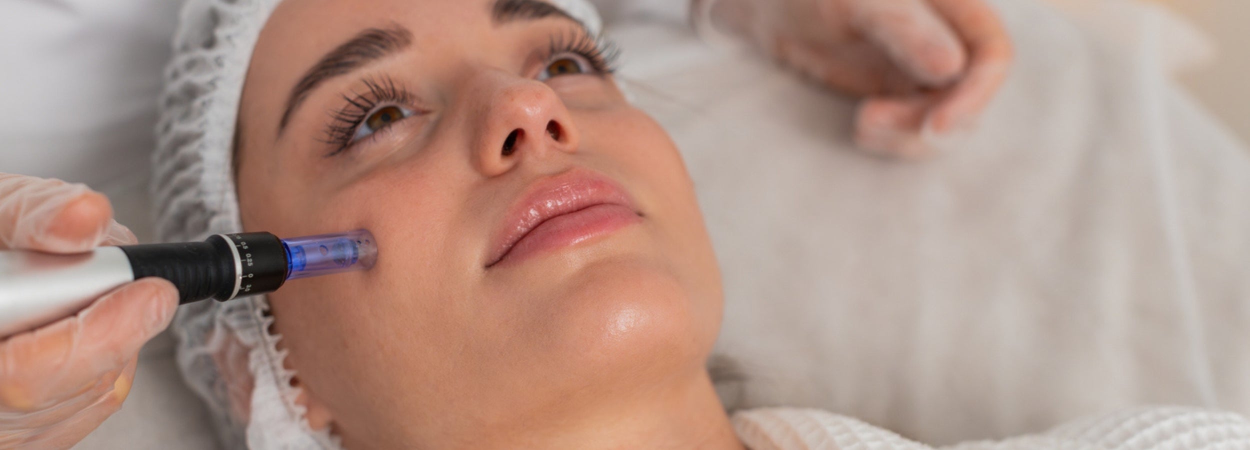 Budgeting for Your Microneedling Sessions