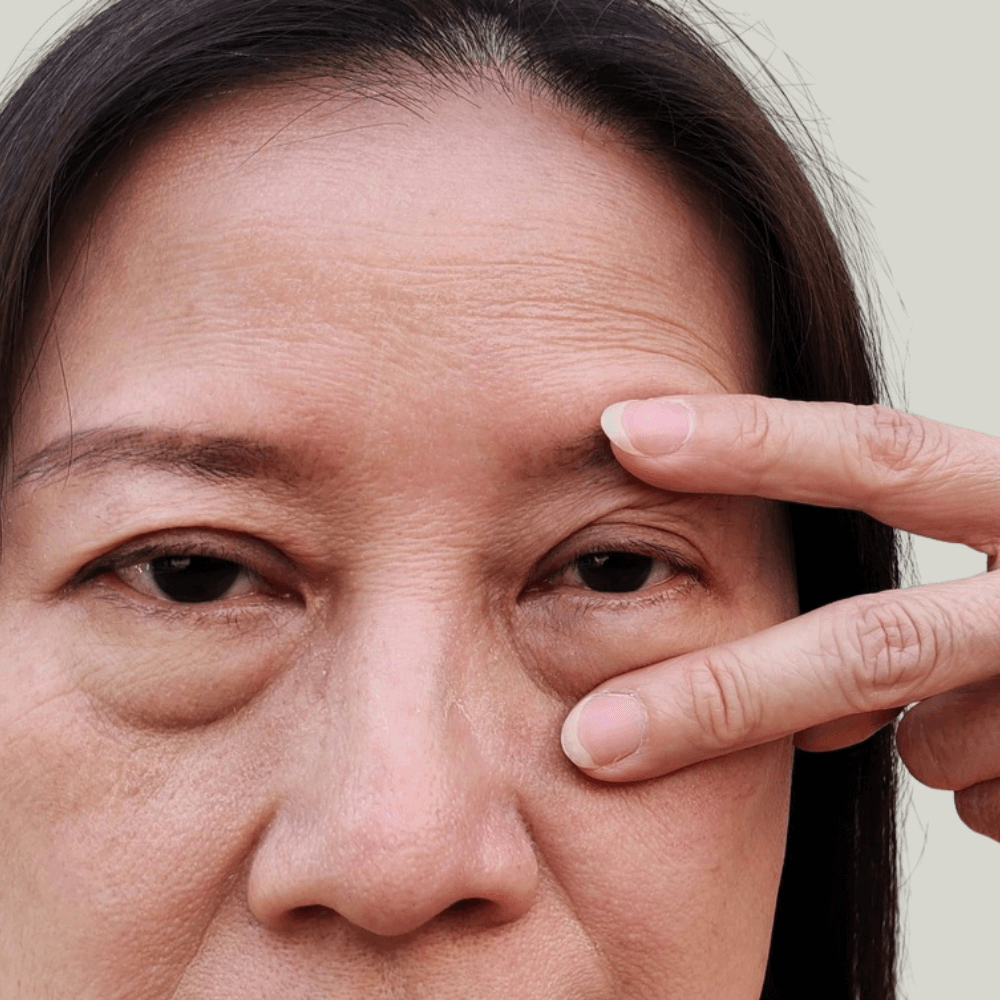 Dull Skin close-up showing tired, lacklustre complexion and under-eye area, highlighting need for radiance-restoring skincare