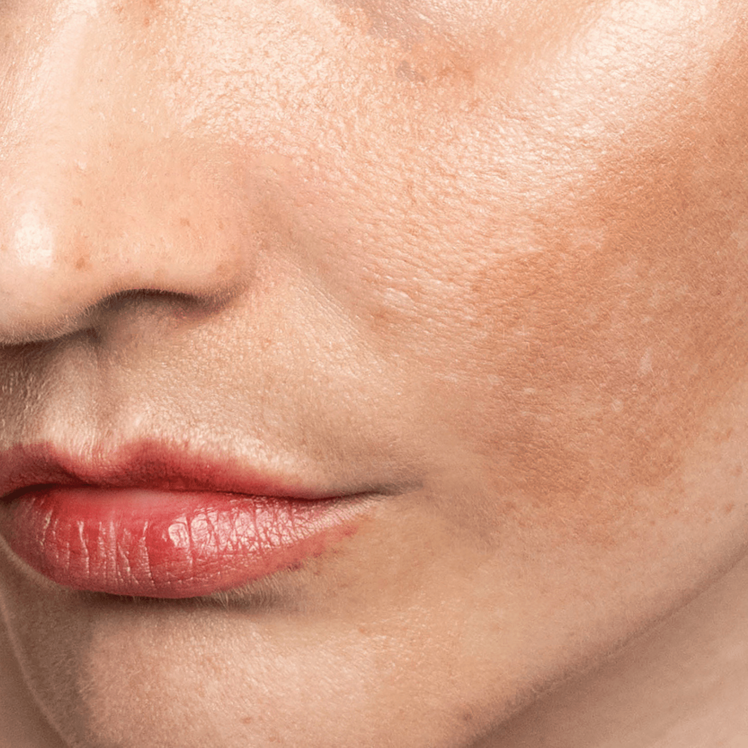 Pigmentation.