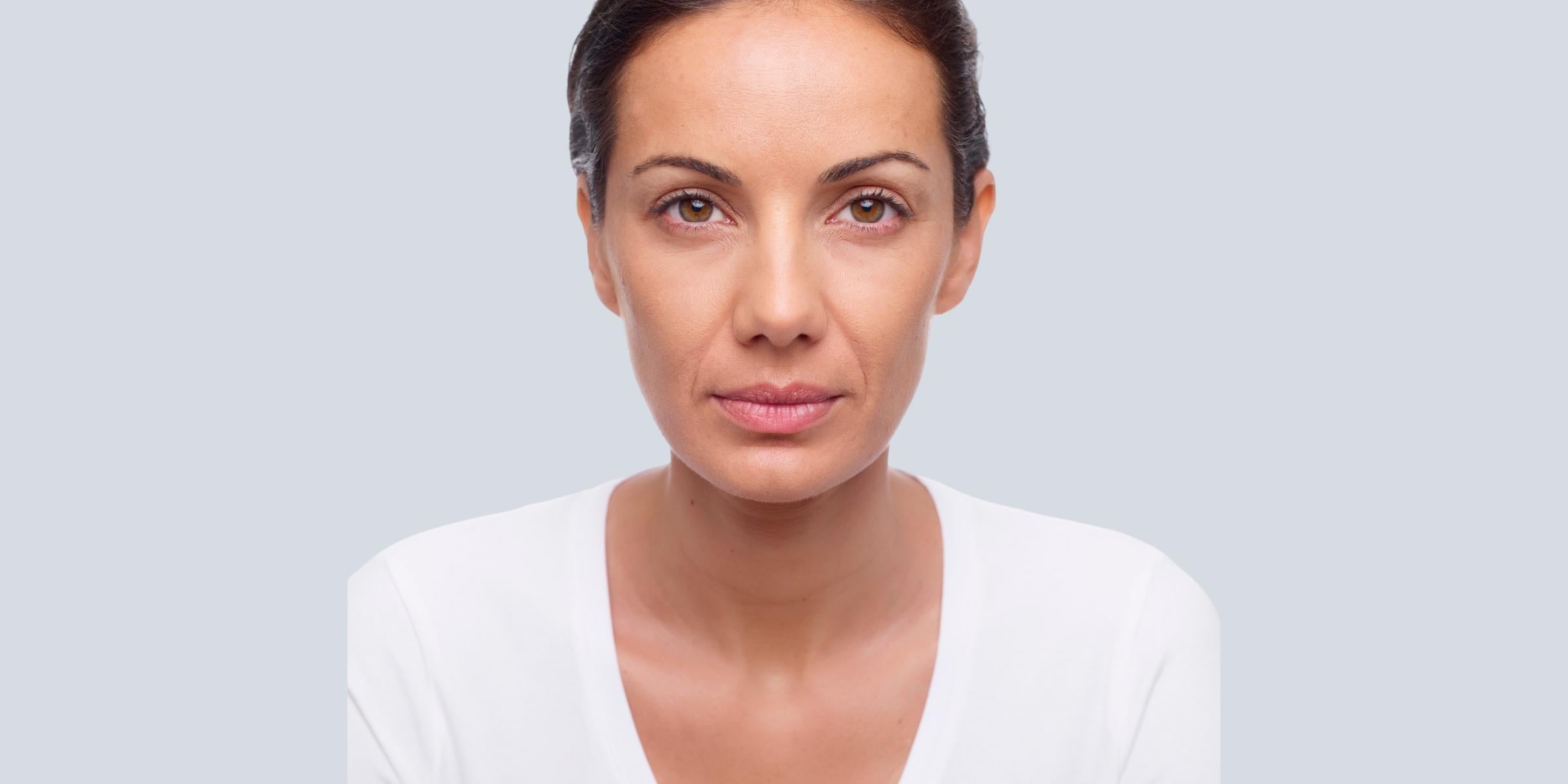 Botox_before