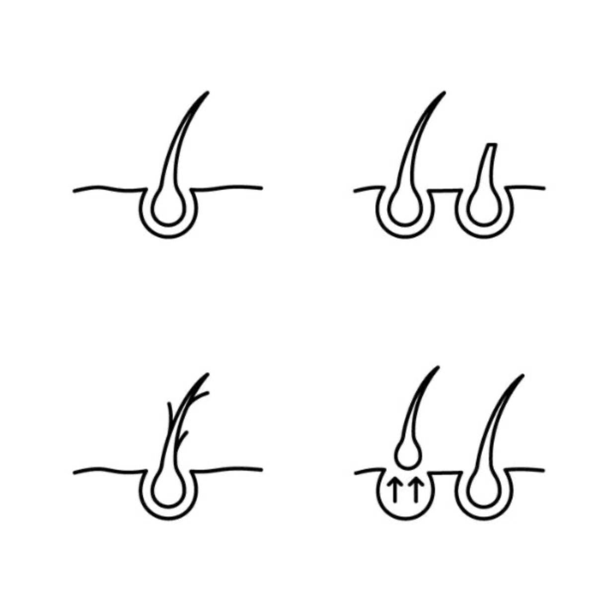 Illustrations of hair follicles on a white background