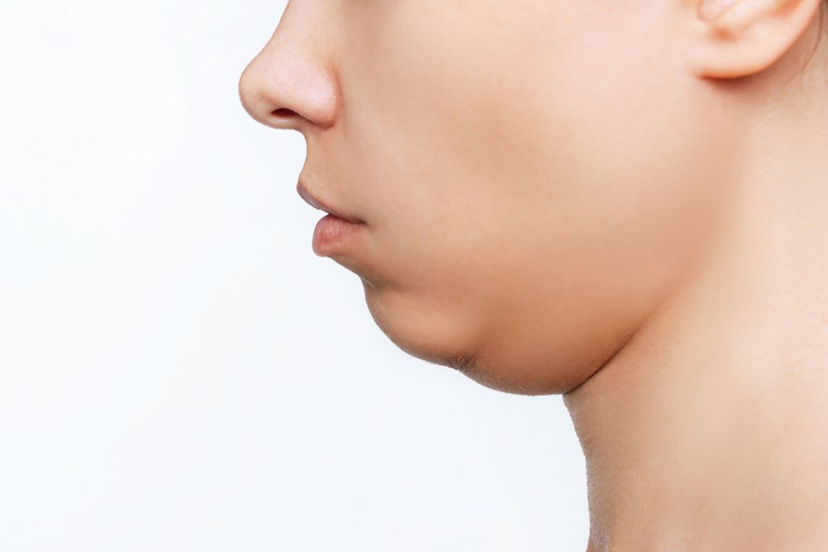 Woman_with_double_chin