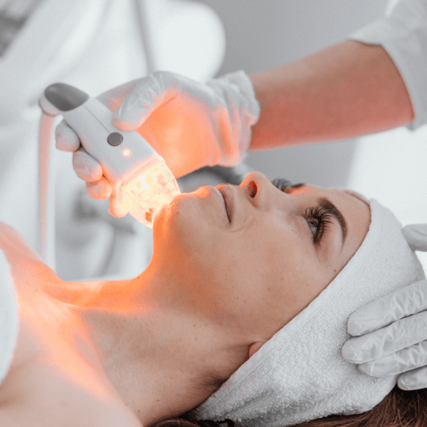Laser Resurfacing - Single Session - Face, Neck, DÃ©colletÃ© treatment with laser device on face for skin rejuvenation