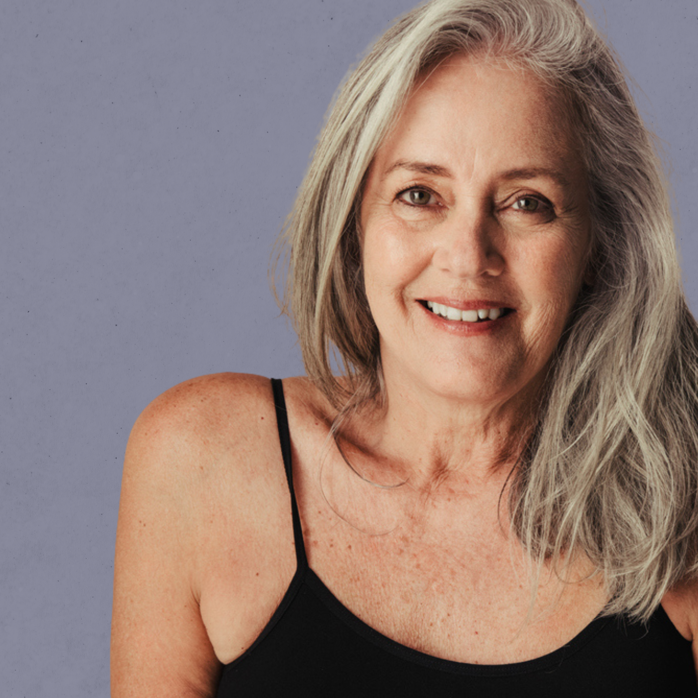 Pigmentation Concerns