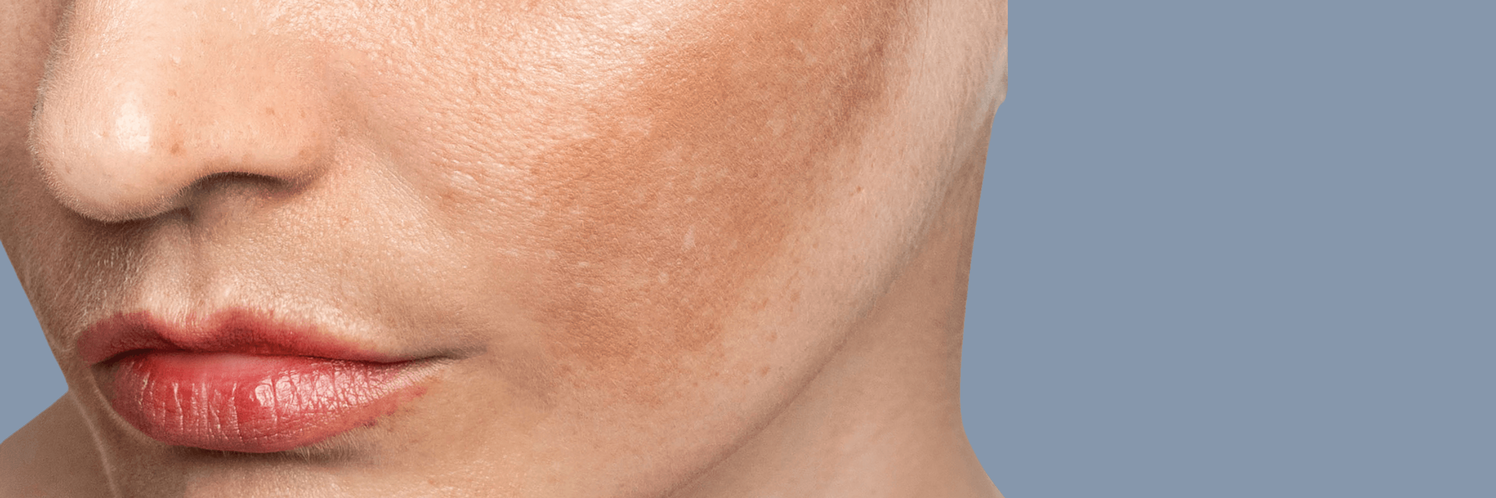 Pigmentation Landscape