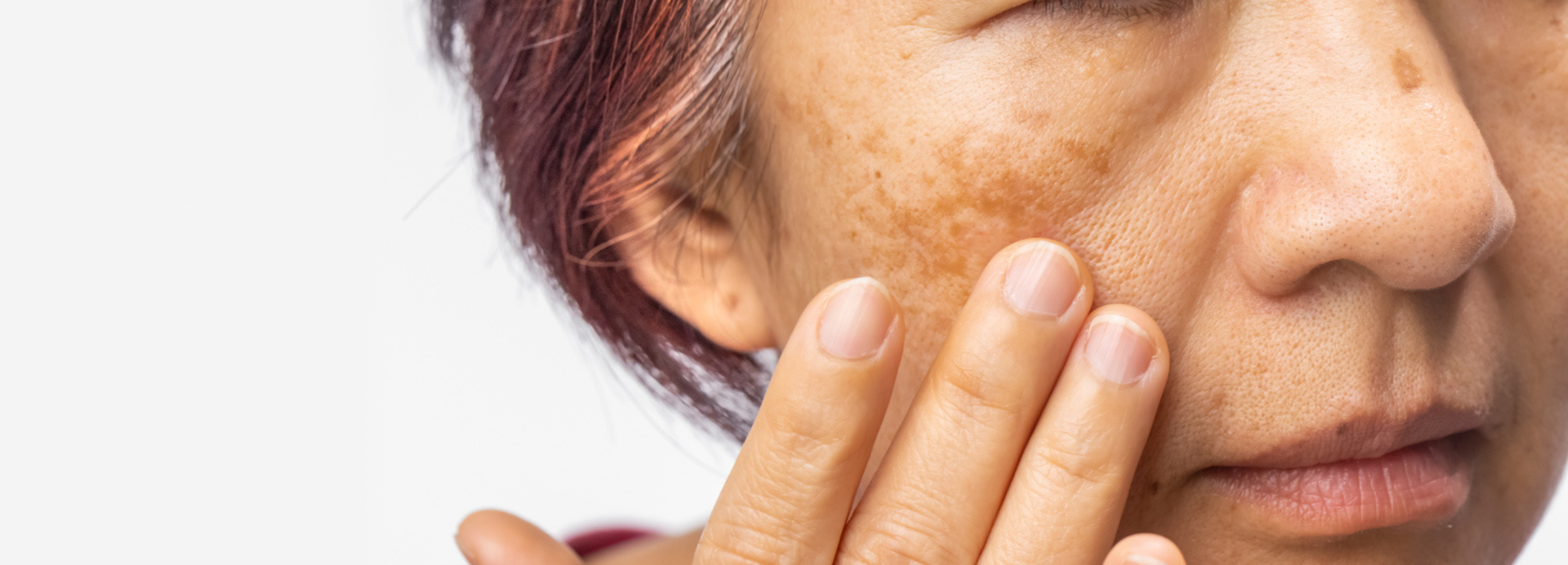 Sagging Skin Landscape